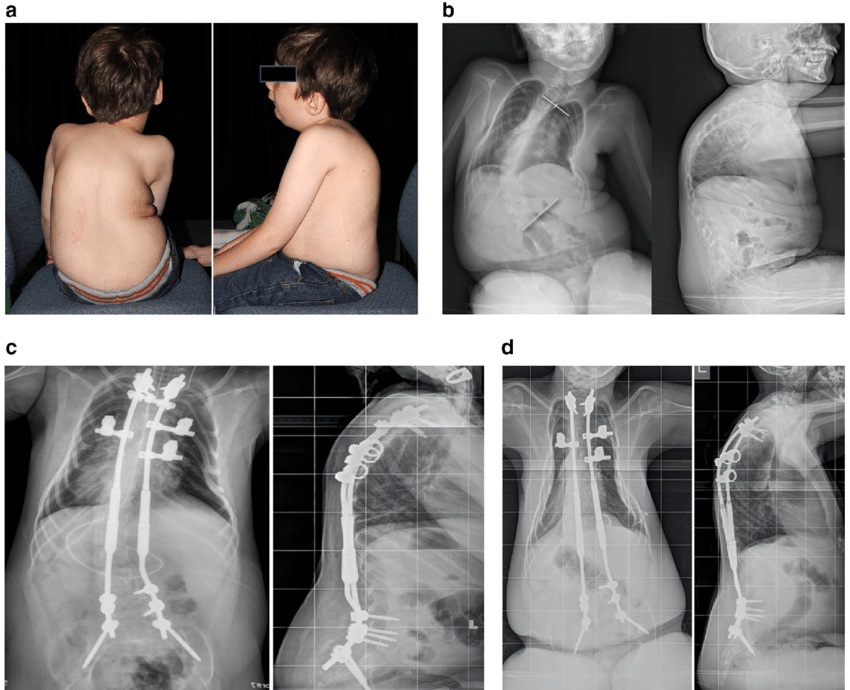Help Save 3-Year-Old Anika Sharma's Life