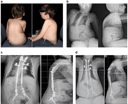 Help Save 3-Year-Old Anika Sharma's Life